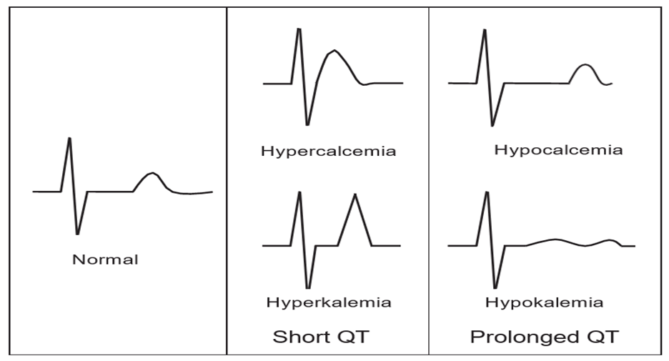 Comparison of Hyperkalemia, Hypercalcemia, Hypokalemia and Hypocalcemia.