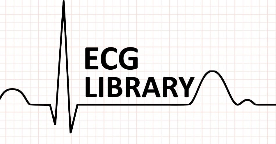 ECG Library